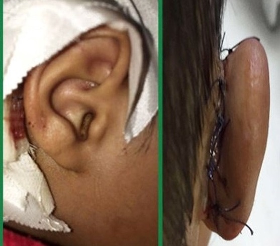 Ù…Ø§Ø¬Ø±Ø§ÛŒ Ø¨Ø±ÛŒØ¯Ù† Ú¯ÙˆØ´ Ú©ÙˆØ¯Ú© Ú©Ø§Ø± ØªÙˆØ³Ø· Ù…Ø§Ù…ÙˆØ±Ø§Ù† Ø´Ù‡Ø±Ø¯Ø§Ø±ÛŒ ØµØ­Øª Ø¯Ø§Ø±Ø¯ØŸ