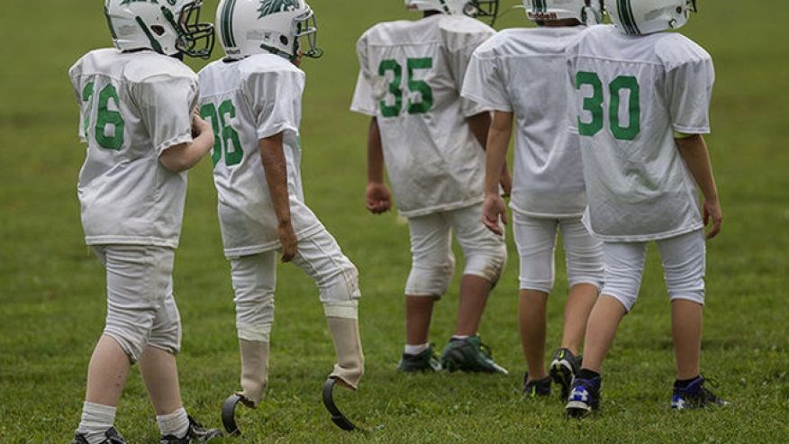 پسری که‎بدون‎پا فوتبال‎بازی‎می‎کند/تصاویر