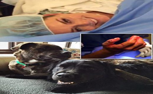 حمله وحشیانه سگ بولداگ به قهرمان اسکی المپیک+ تصاویر