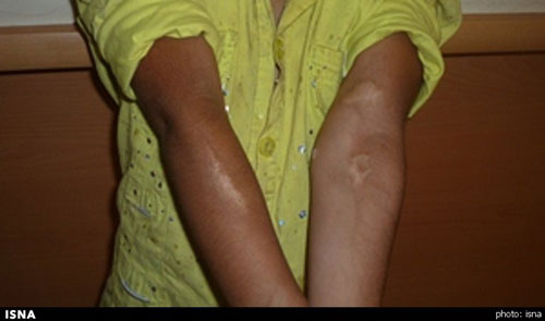 بهزیستی، ستایش را از پدر و مادرش گرفت! +عکس