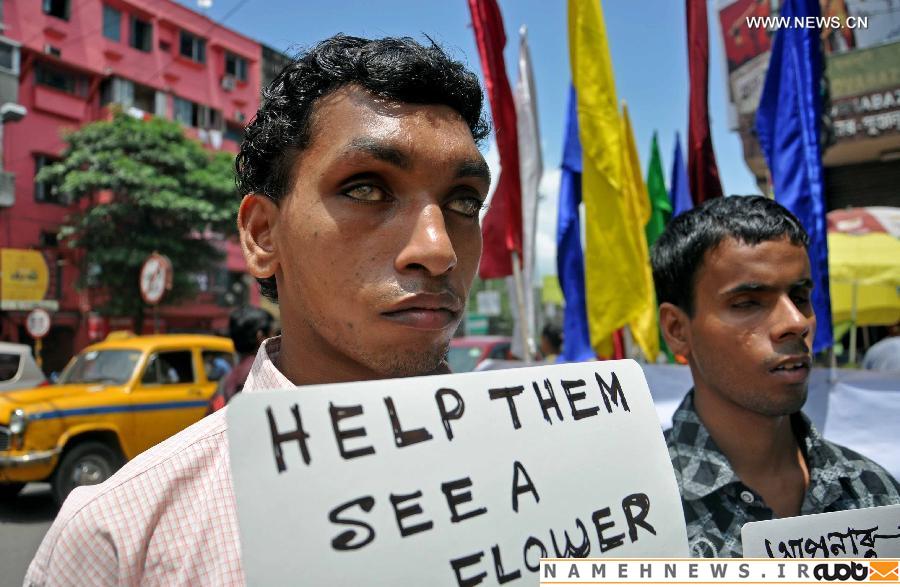 لطفا، چشمانتان را اهدا کنید/ عکس