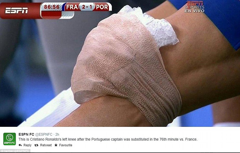 رونالدو دوباره مصدوم شد؟ (عکس)