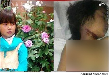 تصاویر/ذبح‌دخترشش‌ساله‌درشهر‌کویته