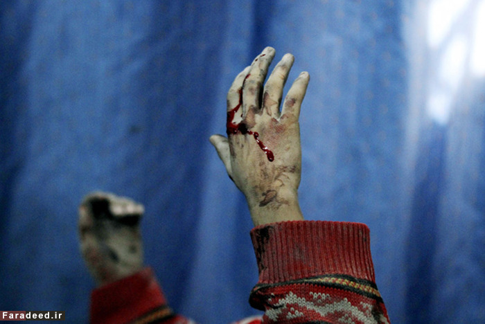 (تصاویر) کودکانی با رنج‌های بزرگ