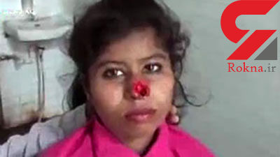 مردی با دندان دماغ لیلا را کَند! + عکس عجیب