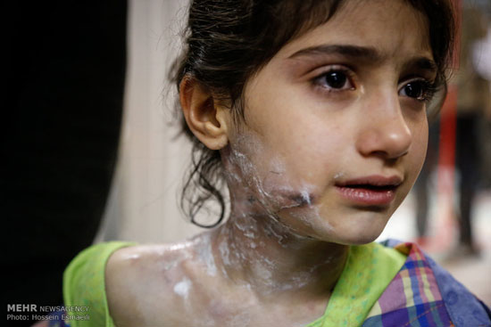 عکس: مصدومان چهارشنبه سوری در تهران