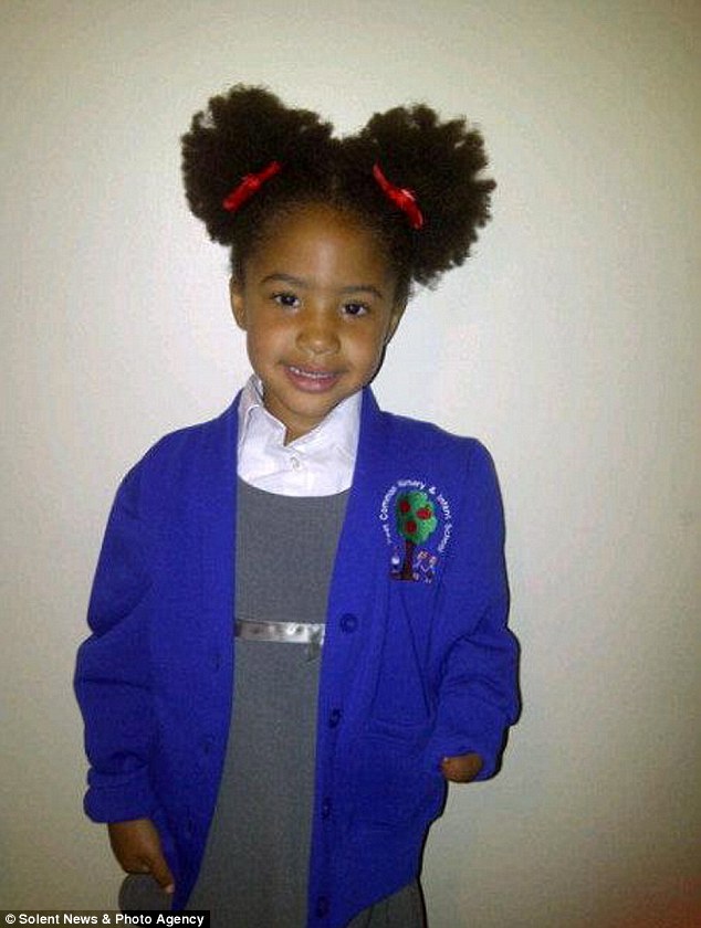 آرزوی دختر بدون دست محقق شد + تصاویر