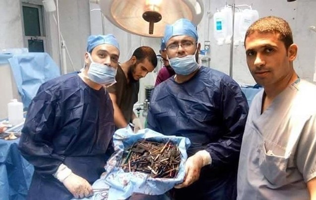 این وسایل عجیب در معده زن مصری پیدا شد!/ عکس