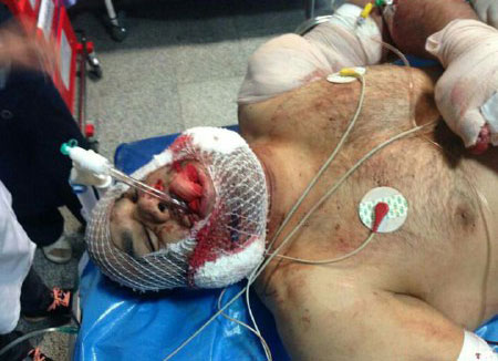 ملی‌پوش کشتی پس از تیراندازی + عکس