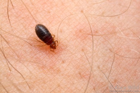 چندش‌آورترین چیزهایی که در گوش پیدا شوده‌اند+تصاویر