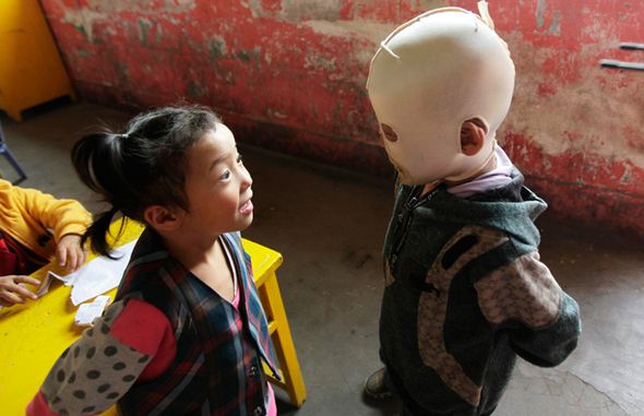 تصاویر : پسر بچه بدون چهره