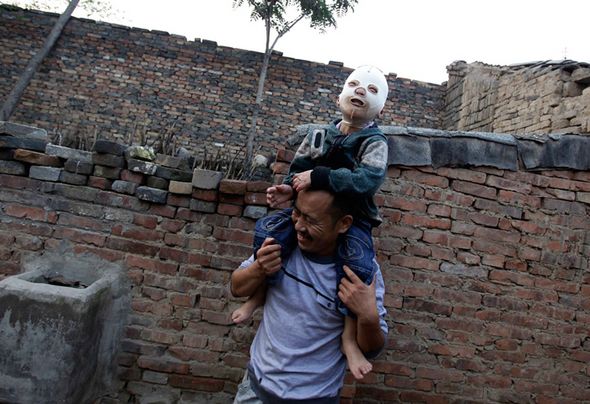 تصاویر : پسر بچه بدون چهره