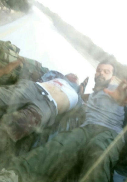 لحظه مجروحیت خبرنگار ایرانی/عکس