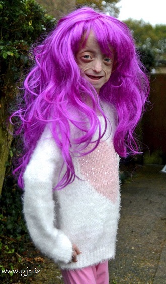 این پیرزن تنها 11 سال سن دارد+تصاویر