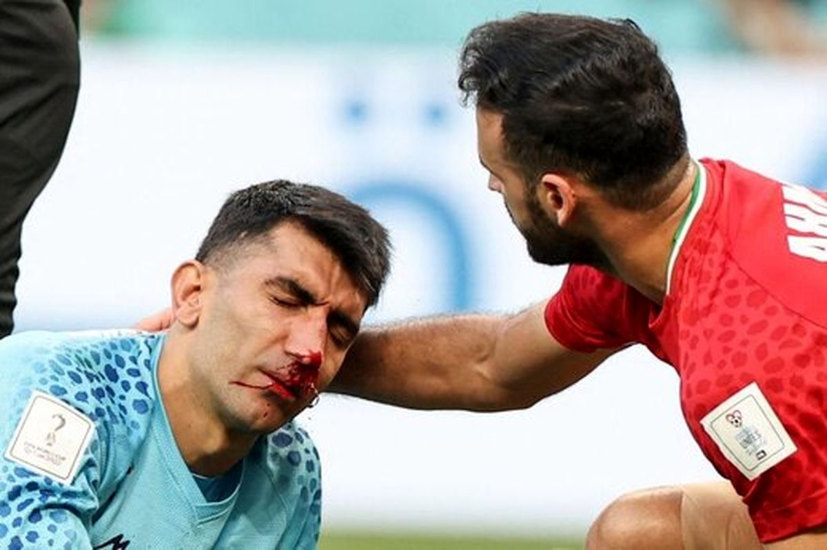 واکنش عجیب رسانه انگلیسی؛ احتمال ضربه مغزی دروازهبان ایران!