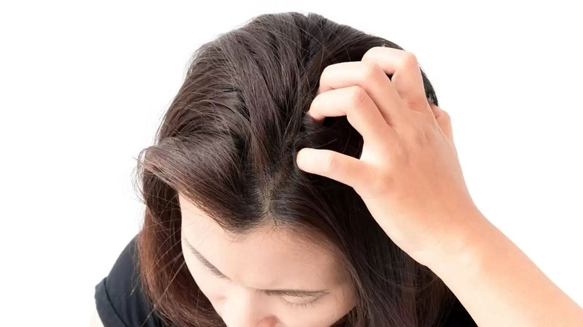 علت خارش پوست سر و روشهای رفع آن